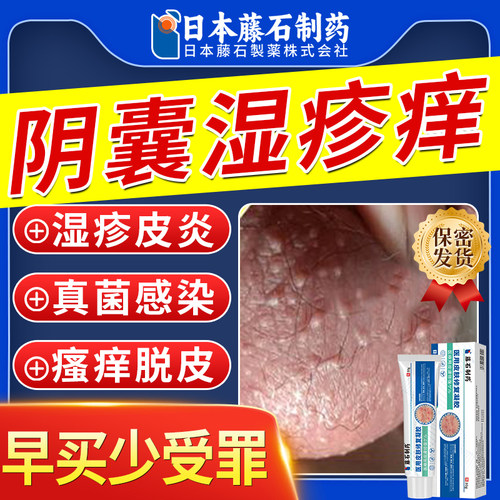阴囊湿疹痒止痒专用男私处睾丸痒
