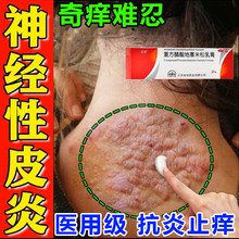 治疗神经性皮炎专用药膏湿疹顽固皮肤瘙痒无激素去除外用止痒药膏
