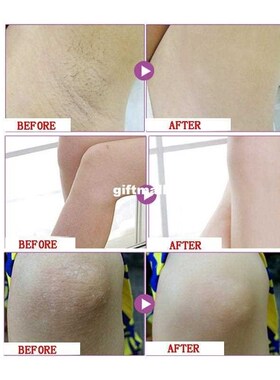 50g Beauty Armpit Whitening Cream Body Underarm Whitening Cr