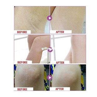 50g Beauty Armpit Whitening Cream Body Underarm Whitening Cr