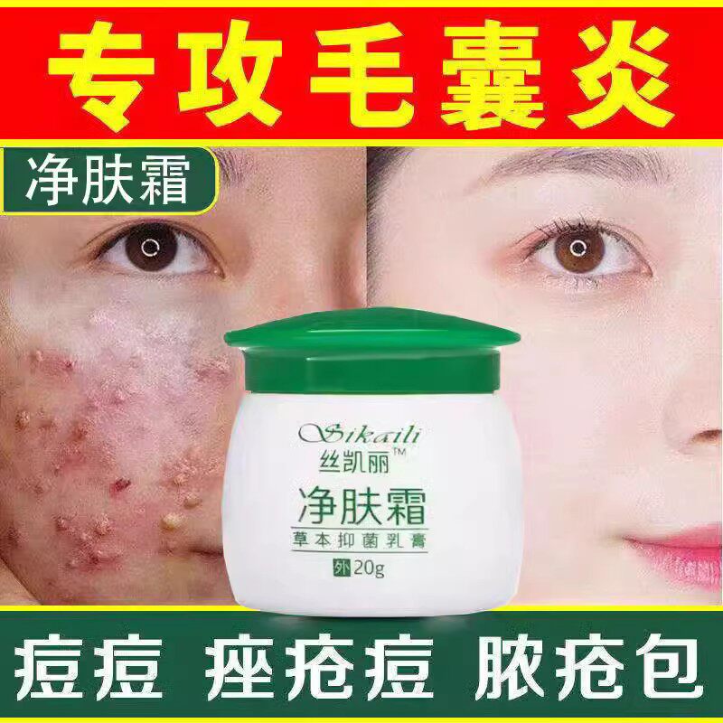 手臂大腿后背脸上皮毛囊炎下身体私处专硬疙瘩胸部用祛痘痘中药膏