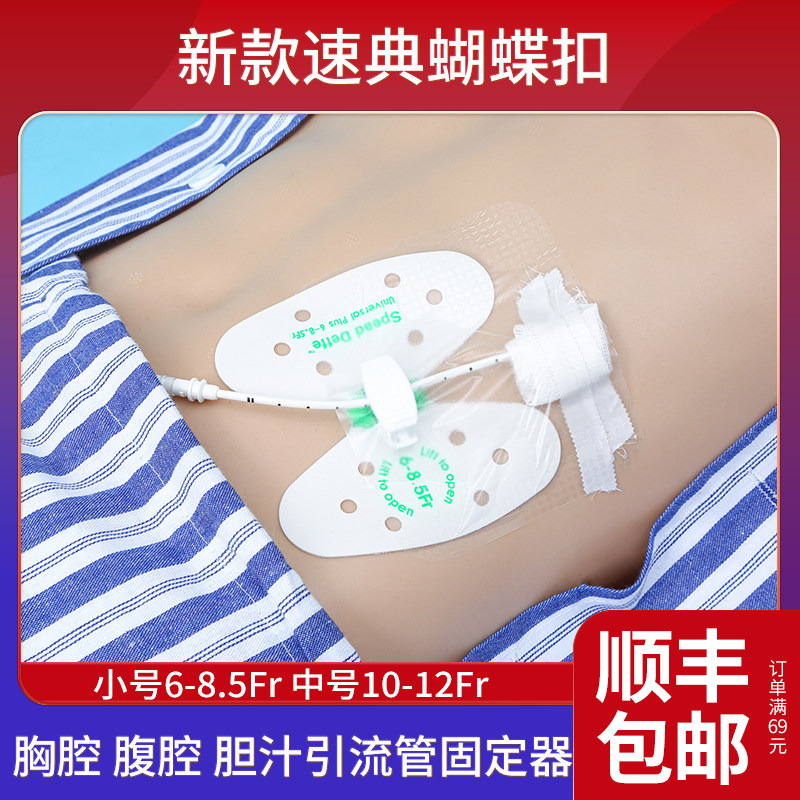 胆管胆汁蝴蝶扣医院同款图片