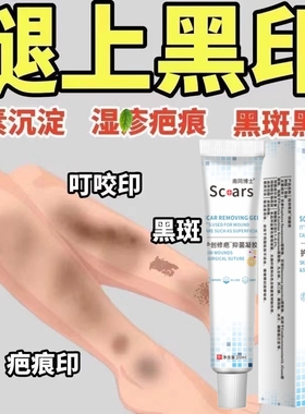 去腿上黑印抓挠结痂蚊虫小腿叮咬疤印淡印黑色素沉淀修复手术伤疤
