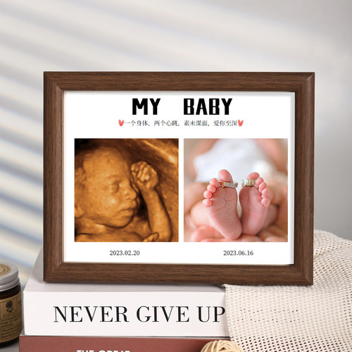 四维照片相框胎儿b超相框
