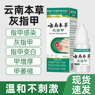 云南本草灰指甲皮肤癣菌甲感染萎缩凹凸不平甲沟炎正品抑菌液