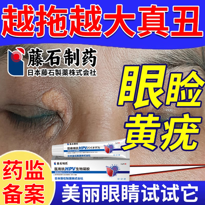 去除眼睑黄瘤专用黄疣黄色瘤丘疹
