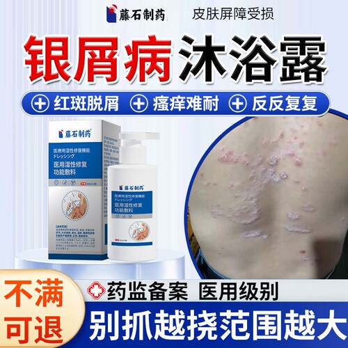 顽固银屑病牛皮癣专用医用辅料沐浴露红斑鳞屑瘙痒全身药房同售QK
