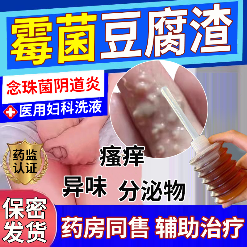 反反复复念珠菌霉菌性阴道炎妇科白带多瘙痒豆腐渣药监备案洗液JA