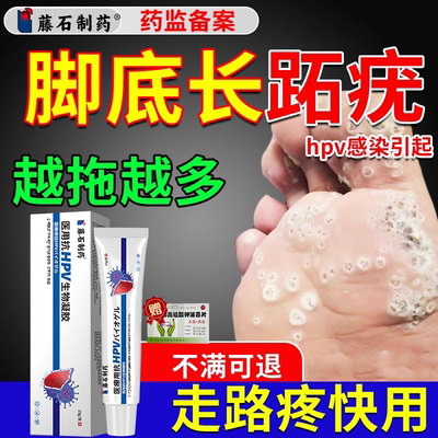 去跖疣专用药房同售膏可搭配碘酊液氮冷冻去跖疣QK