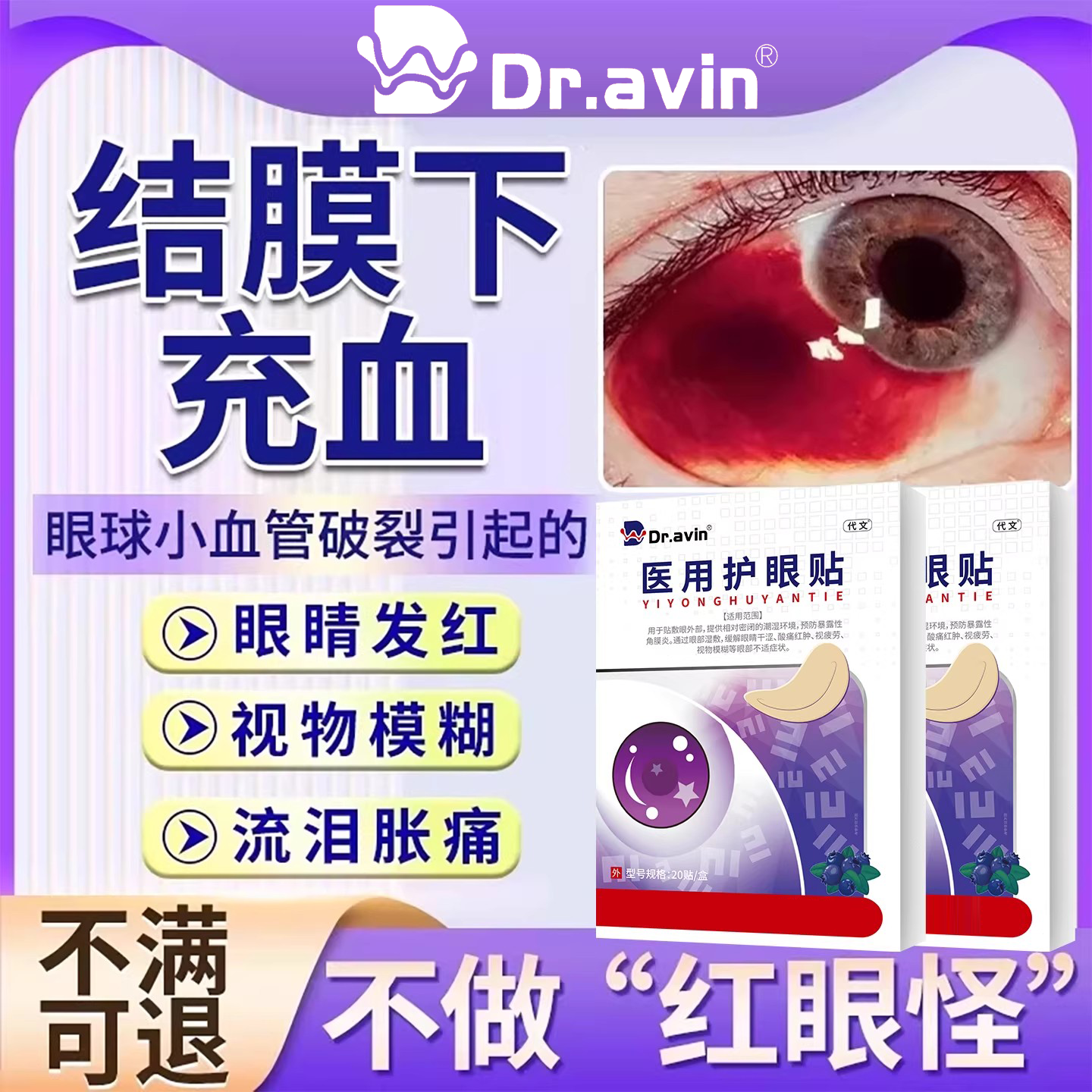 结膜下出血眼底充血眼贴眼角眼睛有血块血管破裂血糖高眼模糊SK
