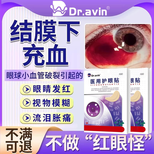 结膜下出血眼底充血眼贴眼角眼睛有血块血管破裂血糖高眼模糊SK