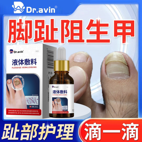 阻生甲脚趾指甲疼痛断裂甲沟炎矫正药房同售膏灰指甲增厚修复QK