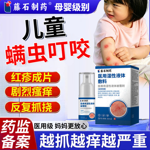 儿童被螨虫叮咬止痒消肿药房同款膏后背脖子皮肤瘙痒过敏红肿YI