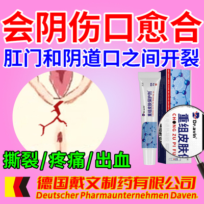 外阴道开裂口药房同售会阴频繁撕裂破皮膏女性私处溃疡疼痛肛门ef