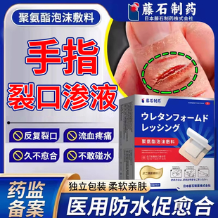 手指裂口愈合贴膏胶布QK创可贴手裂开口子的贴胶布贴防水