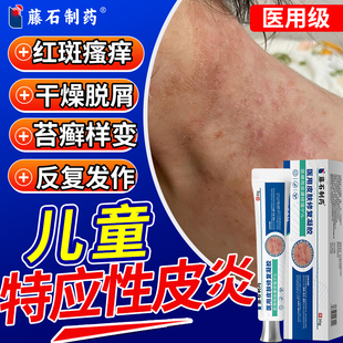 儿童特应性皮炎止痒专用凝胶药房同售软膏去皮肤干燥脱屑瘙痒根QK