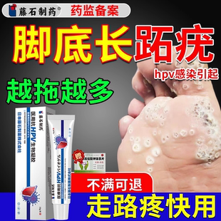去跖疣专用药房同售膏可搭配碘酊液氮冷冻去跖疣QK