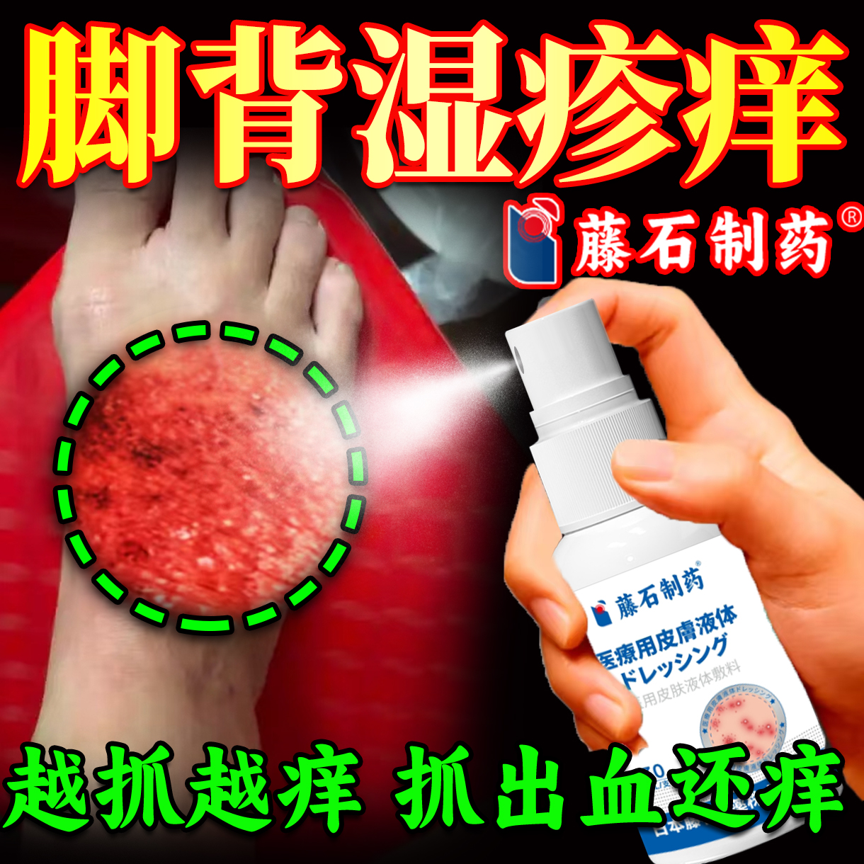 脚上脚背水泡湿疹止痒去专用除湿止痒喷剂可搭配膏皮肤湿疹js
