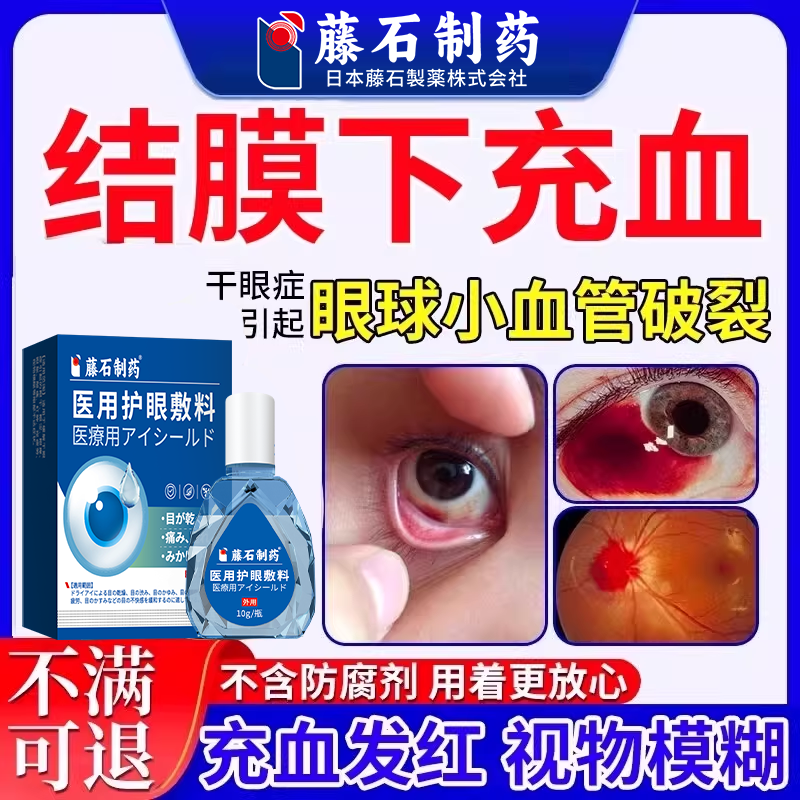 结膜下出血眼底充血眼睛毛细血管破裂的药房同售搭叶黄素滴眼液CA