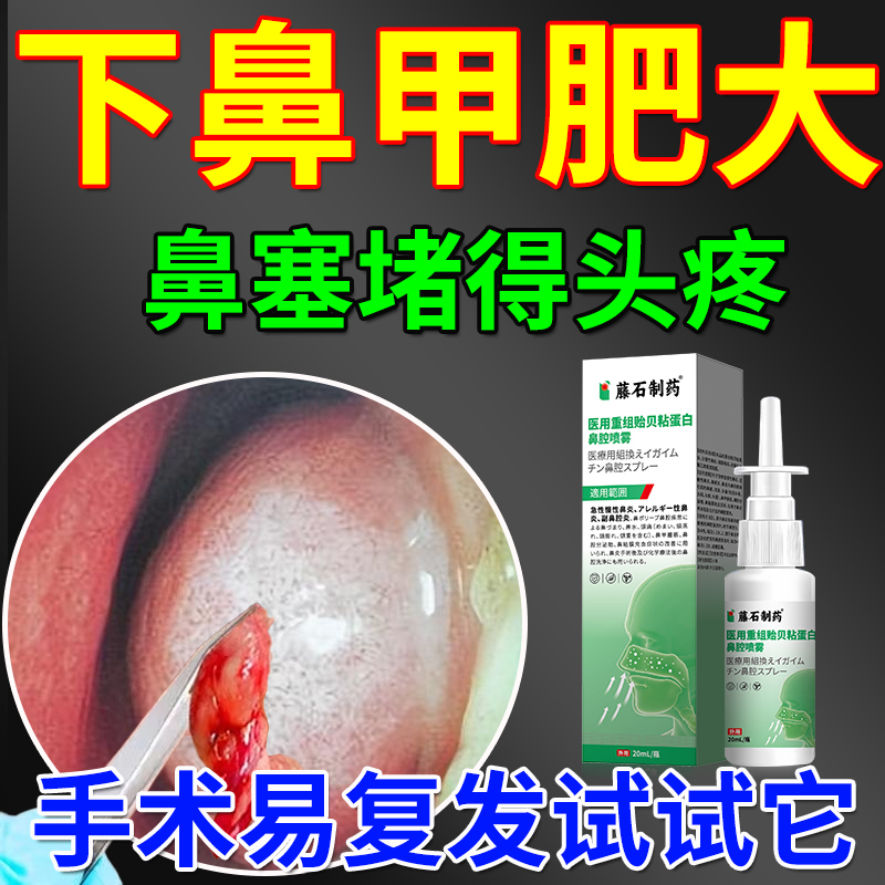 鼻甲肥大消炎修复专用喷雾剂矫正器搭中鼻炎贴儿童药房同售专用QK