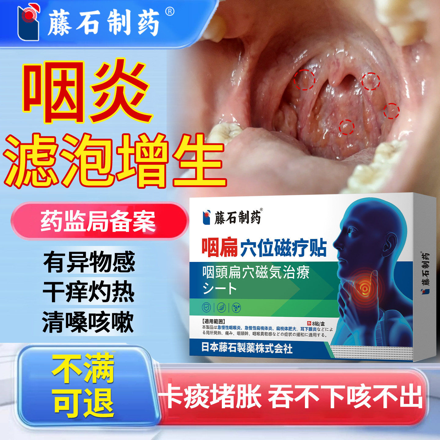 滤泡增生慢性咽炎咽喉根炎除后壁淋巴舌根咽部异物感发炎膏药贴YI