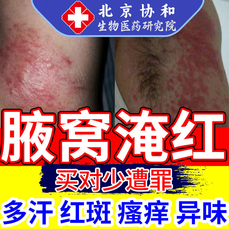 腋下防淹腋下淹红腋窝出汗肿块汗渍长痘痘发红胳肢窝红肿疼痛ca