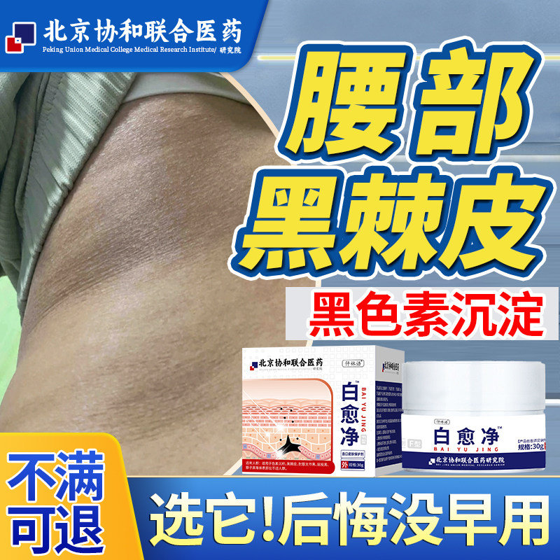 腰部两侧后背黑色素沉淀维生素e乳膏去除淡化黑棘皮肤可搭药膏ef