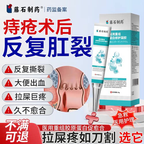 术后肛口狭窄肛裂选对买少受罪