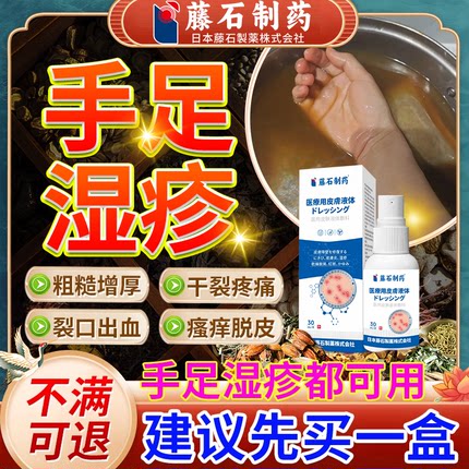 角化型湿疹手癣药房同款脱皮干裂真菌感染皲裂膏手脚湿疹CA
