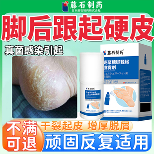 脚后跟干裂起硬皮脚癣真菌感染足跟开裂角化性脚气专用角质型QK