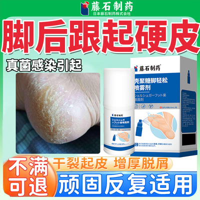 脚后跟干裂起硬皮脚癣真菌感染足跟开裂角化性脚气专用角质型QK