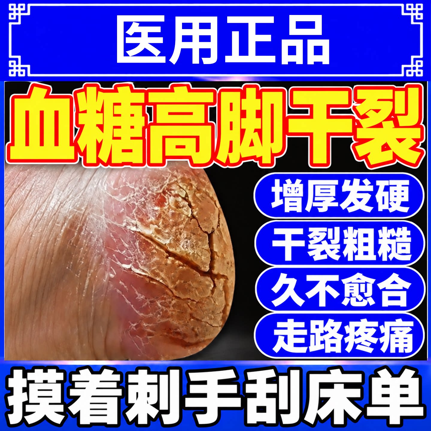 血糖高脚后跟干裂口膏足跟足裂霜脱硬皮医用凡士林防干裂修复膏SK