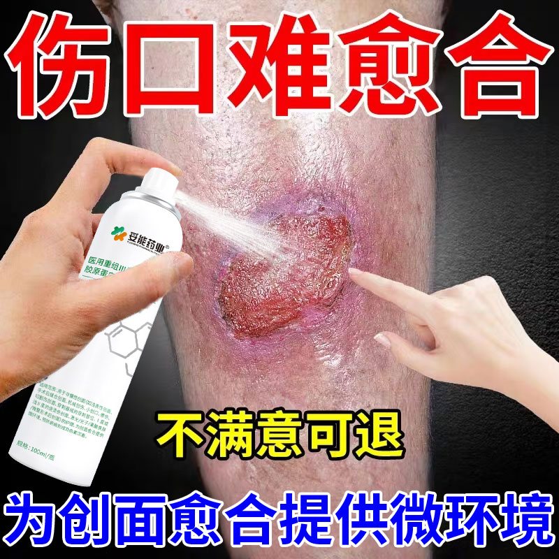 医用重组lll型人源化胶原蛋白修护凝胶喷剂