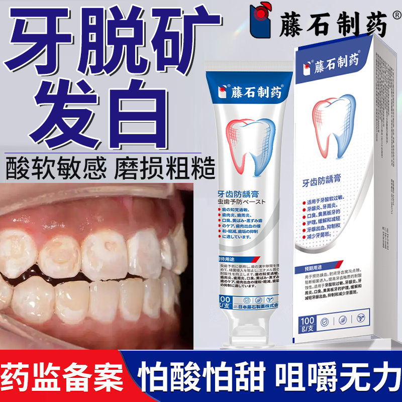 牙齿脱矿白斑牙釉质损伤冷热酸甜敏感酸痛酸软咀嚼无力膏PG