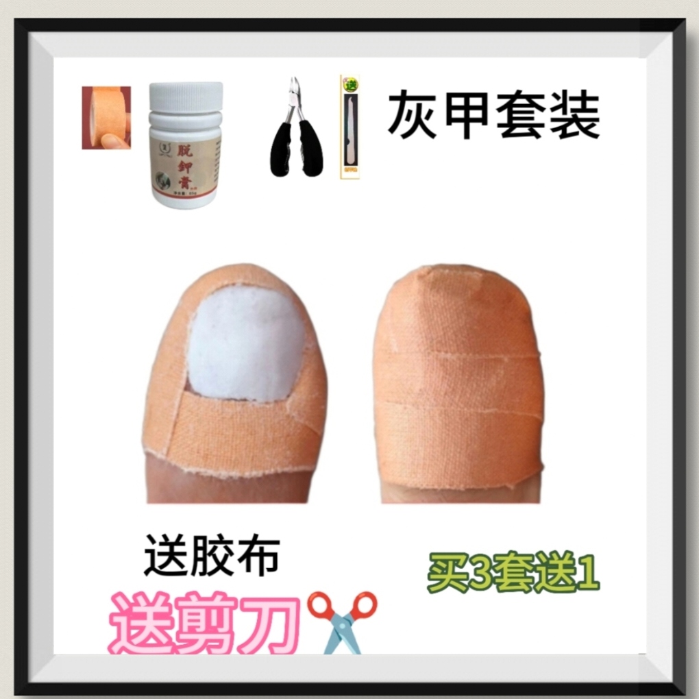 脱甲膏灰甲65克去甲包6天后用热水泡了剪修送胶布剪刀锉刀买3套