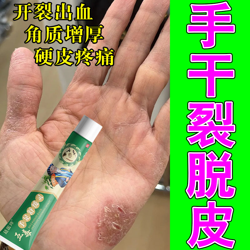 冶手干裂手裂口子手脱皮干裂口换季过敏粗糙干裂痒专用修复乳膏