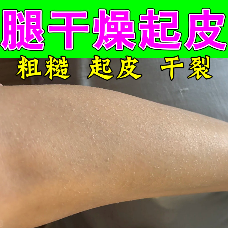 身上皮肤干燥起皮掉皮腿部皮肤干燥粗糙补水保湿修复润肤甘油