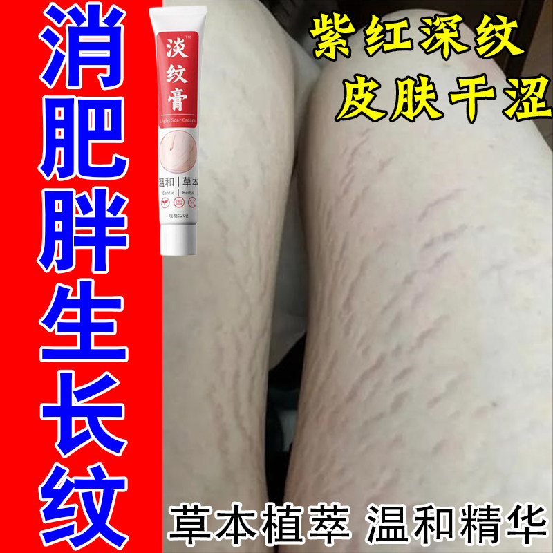 生长纹肥胖纹去大腿内侧纹学生屁股红纹白纹男女专用淡纹修复膏