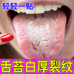 舌头中间有裂纹地图舌头肥大有齿痕舌苔发白厚调理灼口综合症药贴