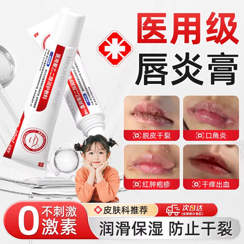 [皮肤科推荐]儿童唇炎膏