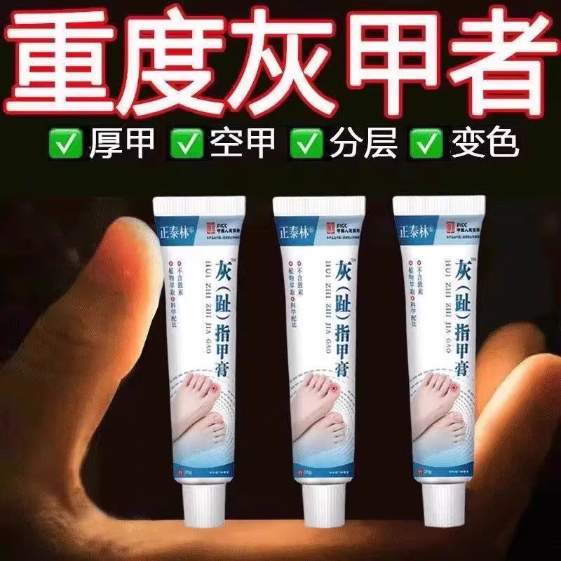 脚指甲增厚灰指甲砖用膏重度厚甲脚趾手指灰指甲正品砖用灰甲净