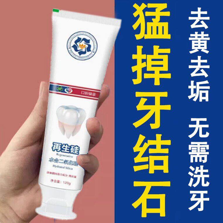 不用去洗牙【刷白了】牙石牙垢嘴巴臭亮白去牙石去渍烟渍牙膏