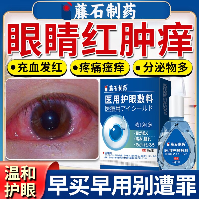 红眼病可搭滴眼液眼药水预防改善眼睛去除红血丝止痒结膜炎充血OZ