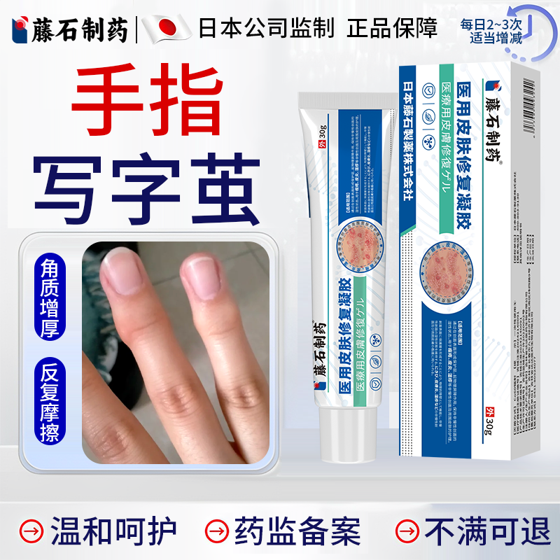 【医用级】手指长茧去除神器