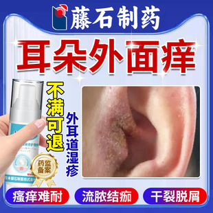 耳朵外面痒外耳道炎湿疹皮炎真菌性感染止痒去有藓根药房同款膏MA