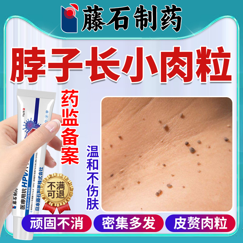 【现货速发】脖子长小肉粒疣去除