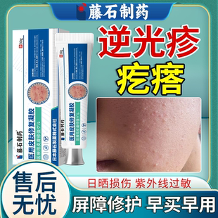 逆光疹屏障修复脸上起小疙瘩额头上痘痘闭口粉刺它藤石制药凝胶OZ