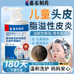 儿童脂溢性皮炎洗发水头皮真菌感染头部喷剂毛囊炎糠疹去屑止痒OZ