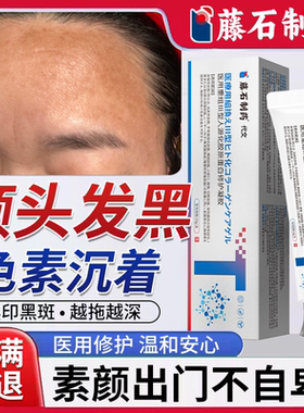 额头黑色素沉淀沉着淡化去除脸部脸上黑斑印医用美白药房同款膏BS