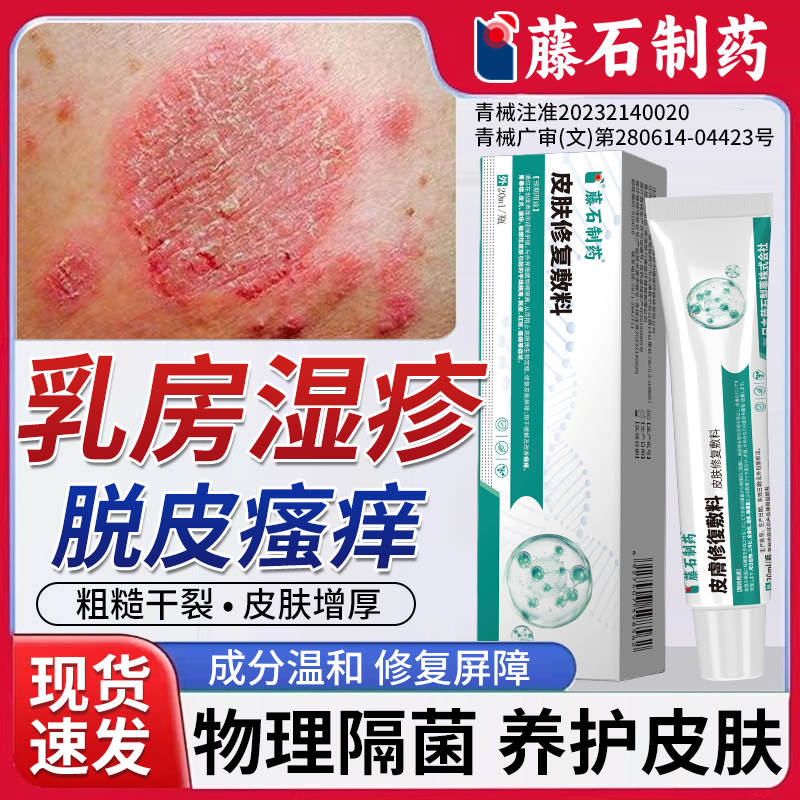 乳头瘙痒乳晕干燥皲裂红斑疙瘩脱皮乳房湿疹抑菌止痒药房同款膏BS